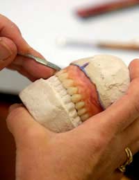 Dentures Dental Implants Fruits