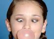 Does Dental Chewing Gum Work?