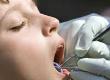 Dental Care For Children