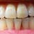 Oral Habits and Dental Damage