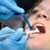 Care and Maintenance of Dental Implants