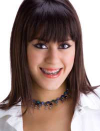 Types Of Braces